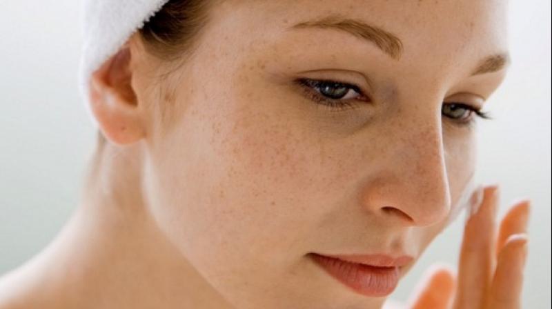 Eliminare i punti neri in modo naturale