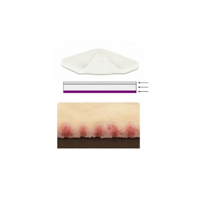 Mepilex Xt Medicazione Poliuretano 10 X 10 Cm Mepilex Xt Medicazione Poliuretano 10 X 10 Cm