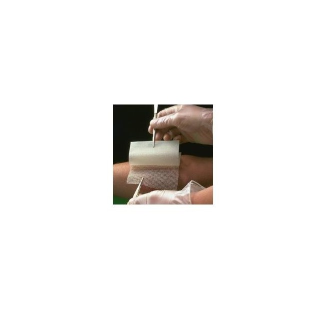 Bactigras garza medicata con clorexidina acetato 0,5% 15x20cm 10 pezzi Bactigras garza medicata con clorexidina acetato 0,5% 15x20cm 10 pezzi