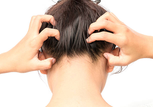 Rimedio forfora efficace: naturale si può?