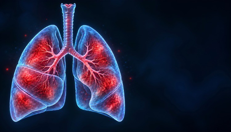 Peste Polmonare: In Russia Scatta l'Allerta. Sintomi, Trasmissione, Cura e Testimonianza Diretta
