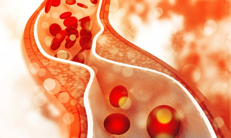Colesterolo alto: 10 cose da sapere se non lo hai