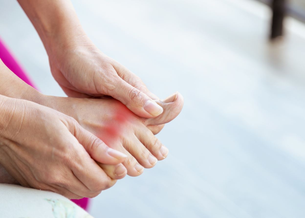 Che cos'è la gotta e quali sono i rimedi naturali?