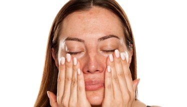 Come trattare le macchie scure sul viso: i rimedi e i prodotti più efficaci Come trattare le macchie scure sul viso: i rimedi e i prodotti più efficaci