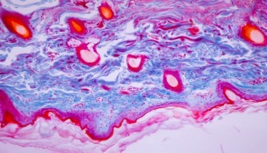 Afamelanotide: Cos'è, a Cosa Serve e Studi Clinici