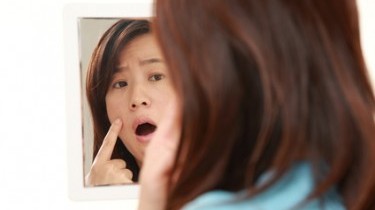 Contare i nei può prevenire il tumore alla pelle