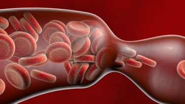 Trombosi, un ‘killer' sottovalutato