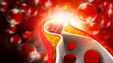 Colesterolo: si abbassa la soglia a rischio