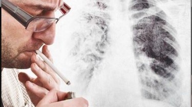 Cancro al polmone: con 'l'immunoterapia 40% di rischio in meno