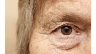 Alzheimer: diagnosi con 10 anni di anticipo